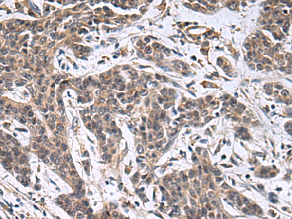 Rabbit Polyclonal Antibody to MBL2