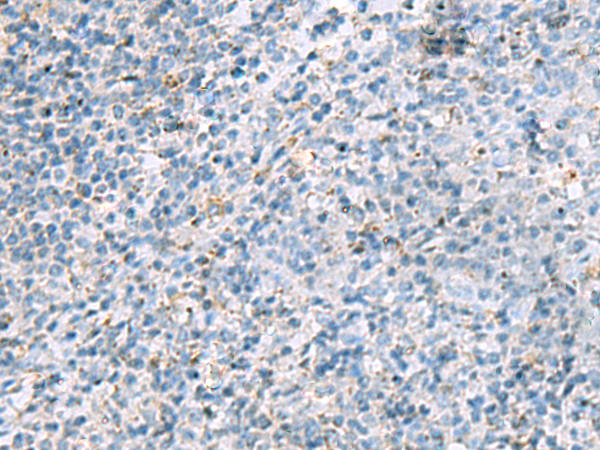 Rabbit Polyclonal Antibody to LRRC4