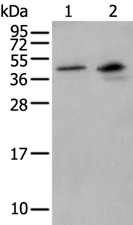 Rabbit Polyclonal Antibody to MAGEB1