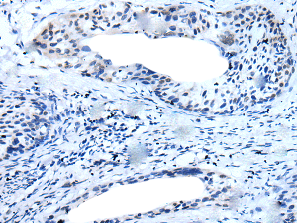 Rabbit Polyclonal Antibody to TMPRSS6