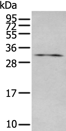 Rabbit Polyclonal Antibody to LAT