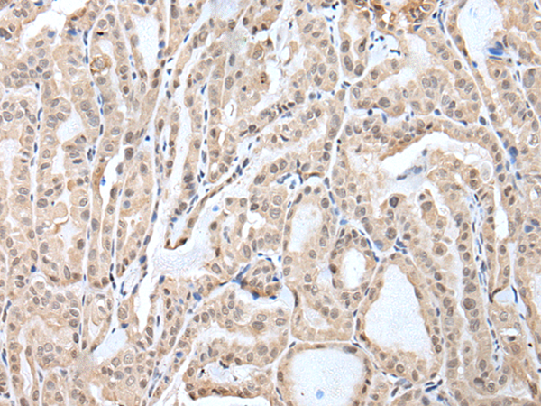 Rabbit Polyclonal Antibody to LRRC23