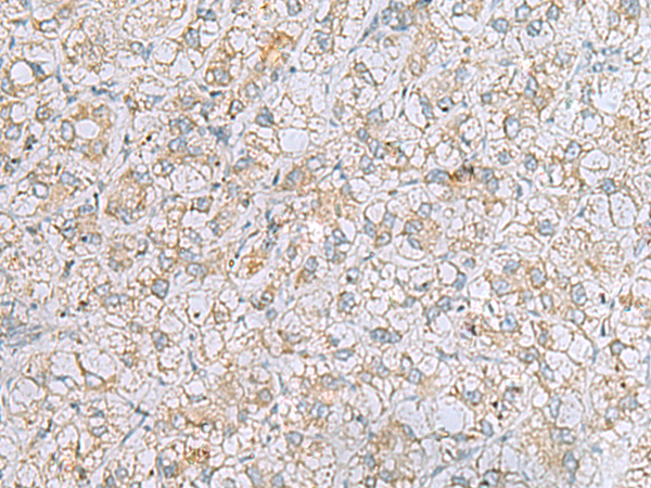 Rabbit Polyclonal Antibody to LRRC49
