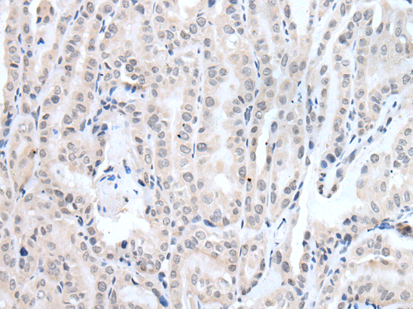 Rabbit Polyclonal Antibody to PPP1R42