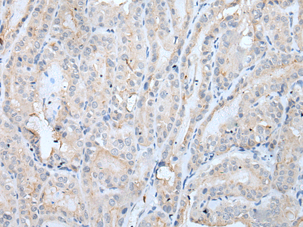Rabbit Polyclonal Antibody to MAGEB5