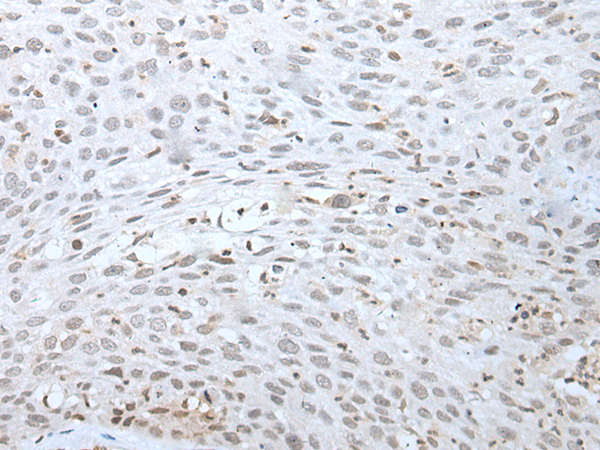 Rabbit Polyclonal Antibody to MEF2C
