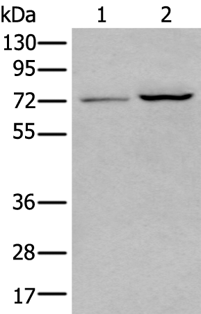 Rabbit Polyclonal Antibody to MEN1