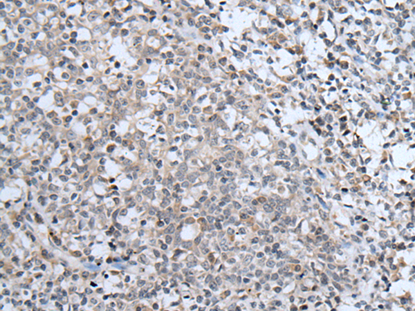 Rabbit Polyclonal Antibody to ABCA6