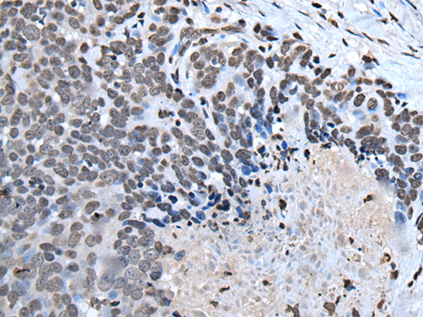 Rabbit Polyclonal Antibody to HOXD1
