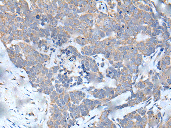Rabbit Polyclonal Antibody to MATN2