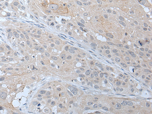 Rabbit Polyclonal Antibody to ABHD6