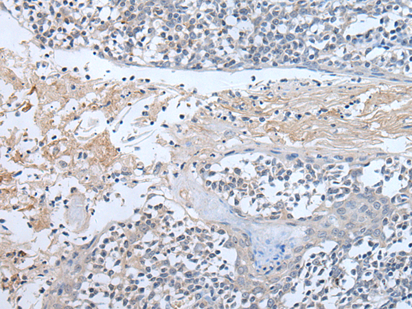 Rabbit Polyclonal Antibody to ABR