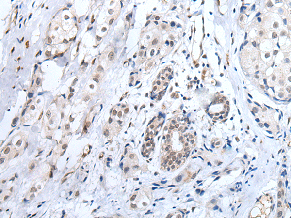Rabbit Polyclonal Antibody to ADAMTS7