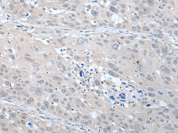 Rabbit Polyclonal Antibody to ANGPTL6