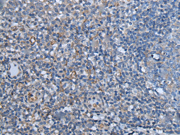 Rabbit Polyclonal Antibody to KLRK1