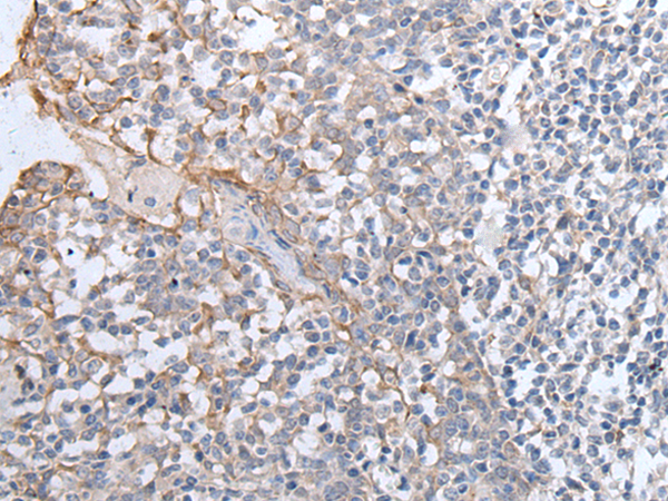 Rabbit Polyclonal Antibody to GPD2