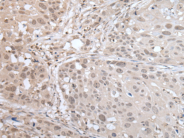 Rabbit Polyclonal Antibody to MAGED1