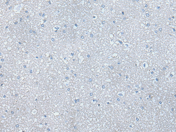 Rabbit Polyclonal Antibody to PIK3CA