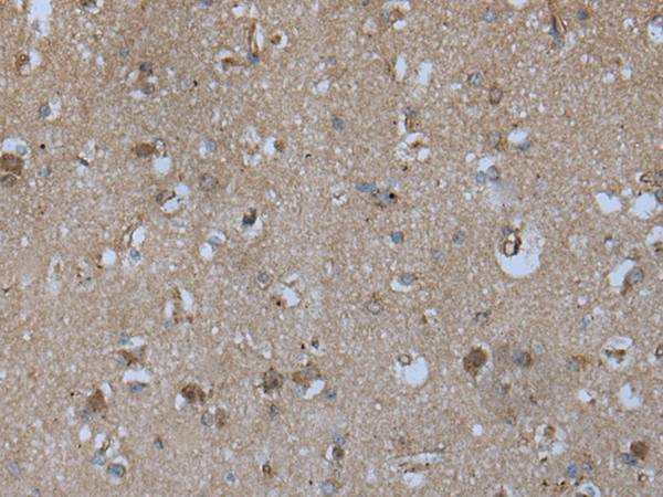 Rabbit Polyclonal Antibody to EPHA5