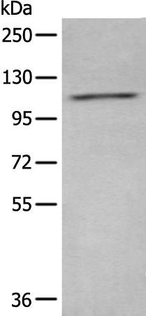 Rabbit Polyclonal Antibody to ADCY2