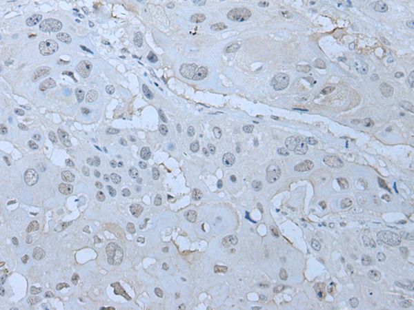 Rabbit Polyclonal Antibody to HUWE1