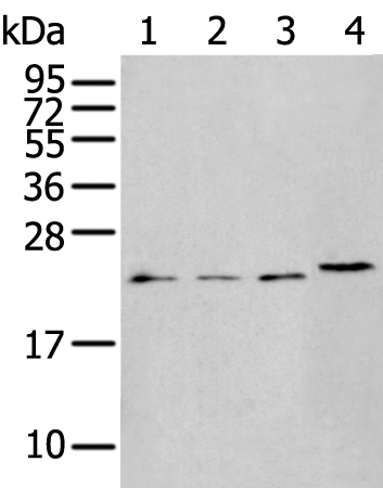 Rabbit Polyclonal Antibody to POMC