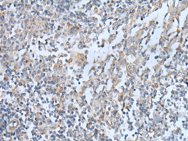 Rabbit Polyclonal Antibody to CENPF