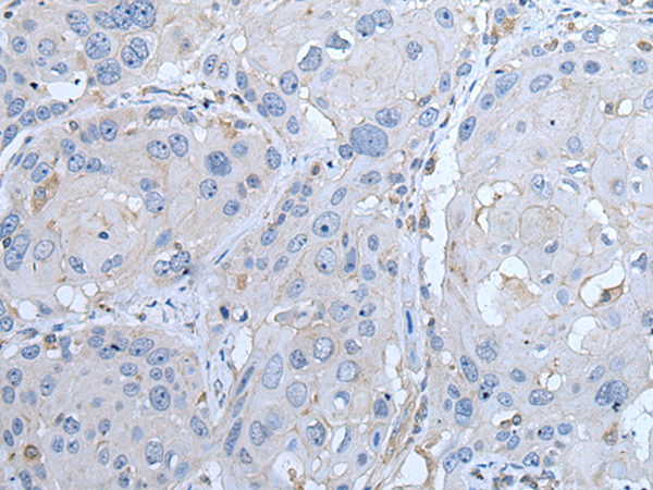 Rabbit Polyclonal Antibody to LTBP4