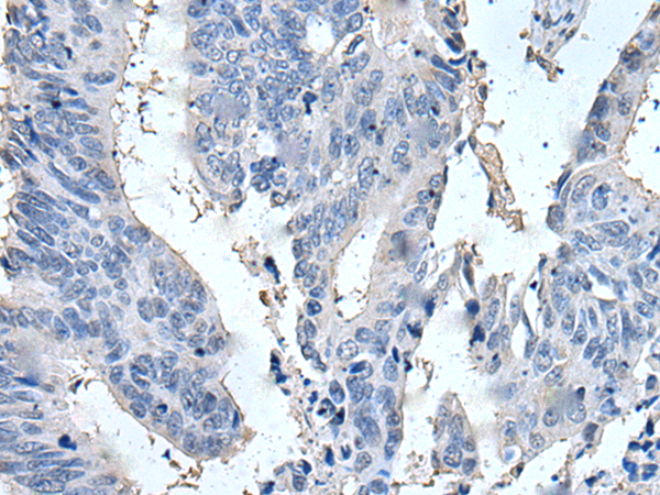 Rabbit Polyclonal Antibody to SCGB2A1