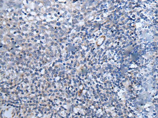 Rabbit Polyclonal Antibody to PAPPA-AS1