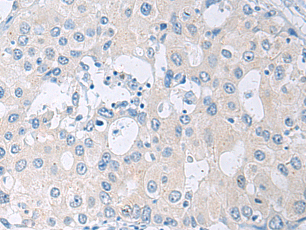 Rabbit Polyclonal Antibody to SLC23A1