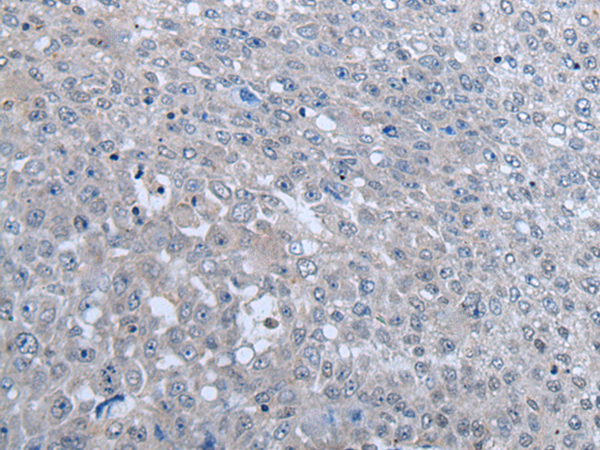 Rabbit Polyclonal Antibody to MTHFR