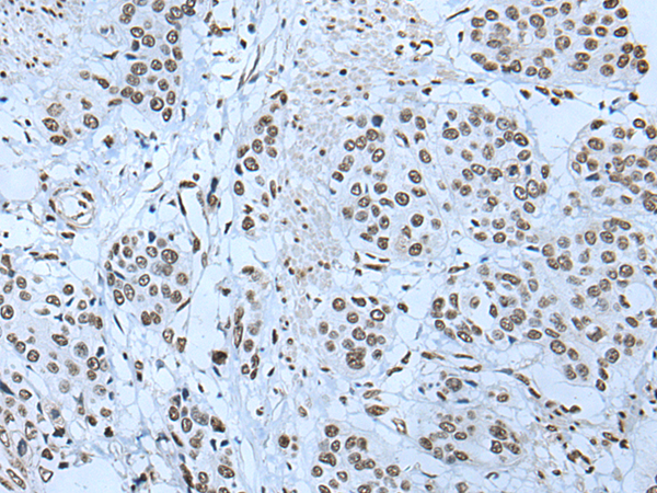 Rabbit Polyclonal Antibody to ZBTB4