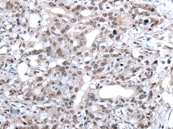 Rabbit Polyclonal Antibody to ZC3H4