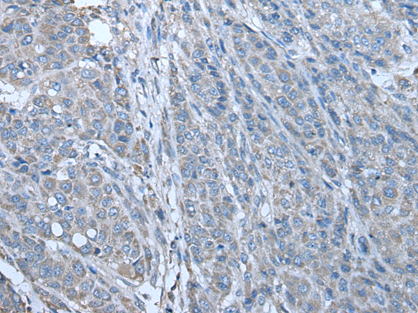 Rabbit Polyclonal Antibody to ZC3HAV1