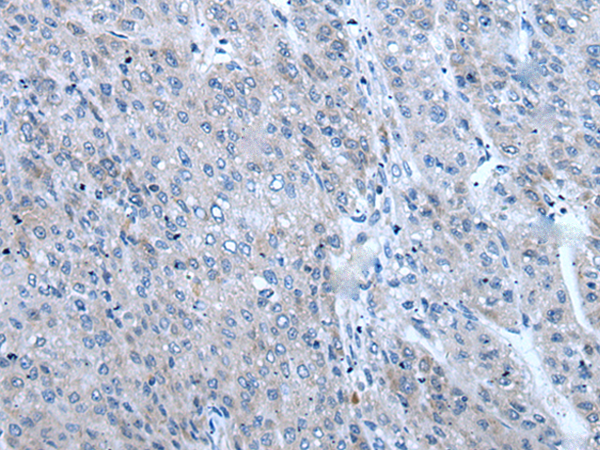 Rabbit Polyclonal Antibody to ZIC1