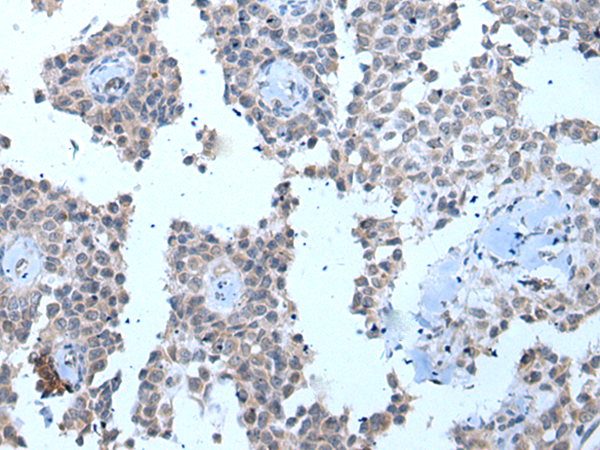 Rabbit Polyclonal Antibody to ZMYM2