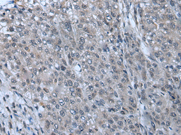 Rabbit Polyclonal Antibody to ZNF143