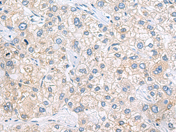 Rabbit Polyclonal Antibody to ZNF35