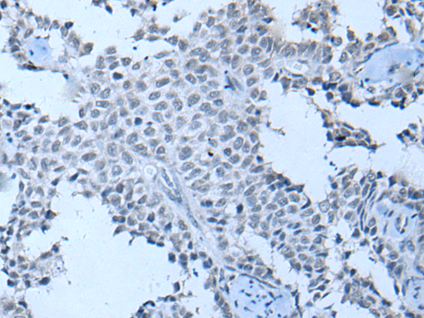 Rabbit Polyclonal Antibody to ZNF703