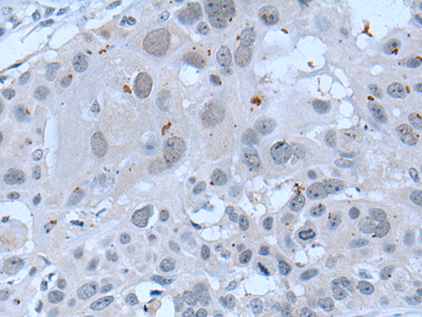 Rabbit Polyclonal Antibody to ZNF787