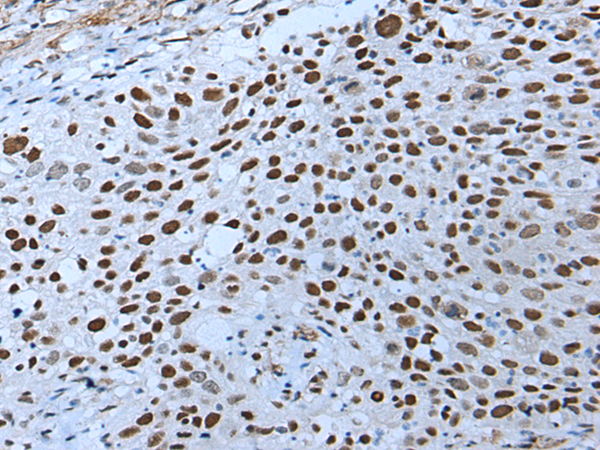 Rabbit Polyclonal Antibody to ZNHIT3