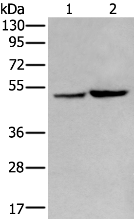 Rabbit Polyclonal Antibody to ZPLD1