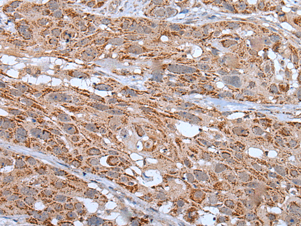 Rabbit Polyclonal Antibody to NOS3