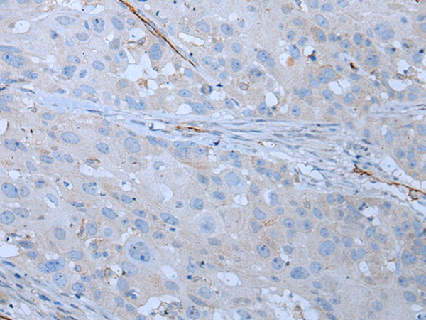 Rabbit Polyclonal Antibody to CD34