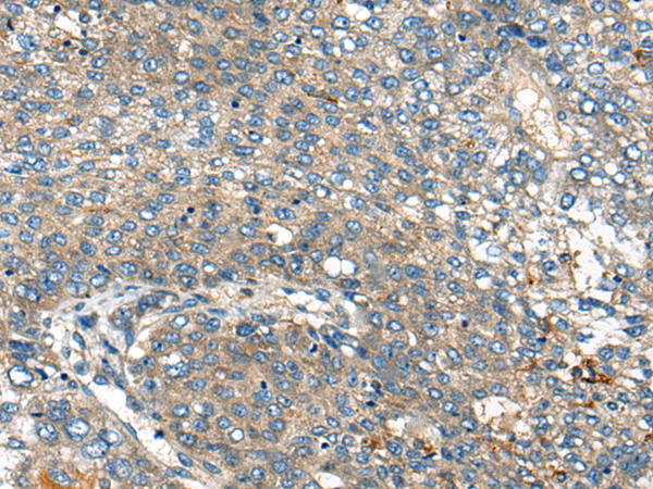 Rabbit Polyclonal Antibody to APP (Beta-amyloid protein 42/40)