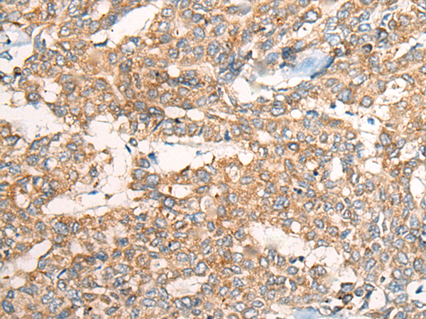 Rabbit Polyclonal Antibody to CASP4