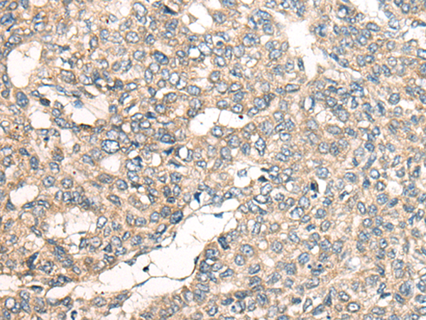 Rabbit Polyclonal Antibody to LRP1B