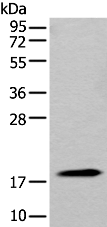 Rabbit Polyclonal Antibody to MYL12B