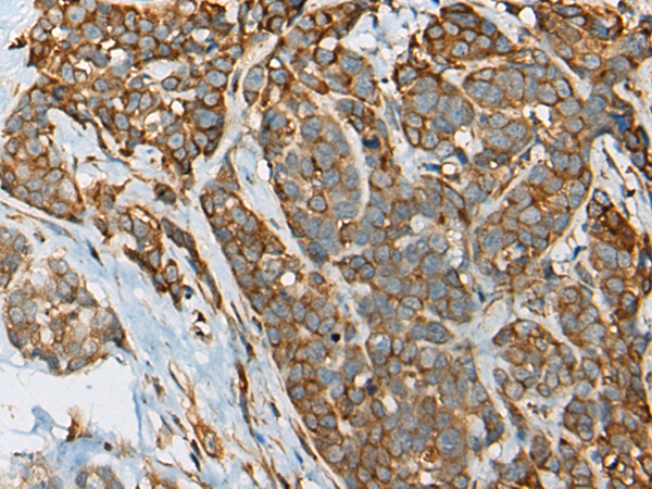Rabbit Polyclonal Antibody to YBX1